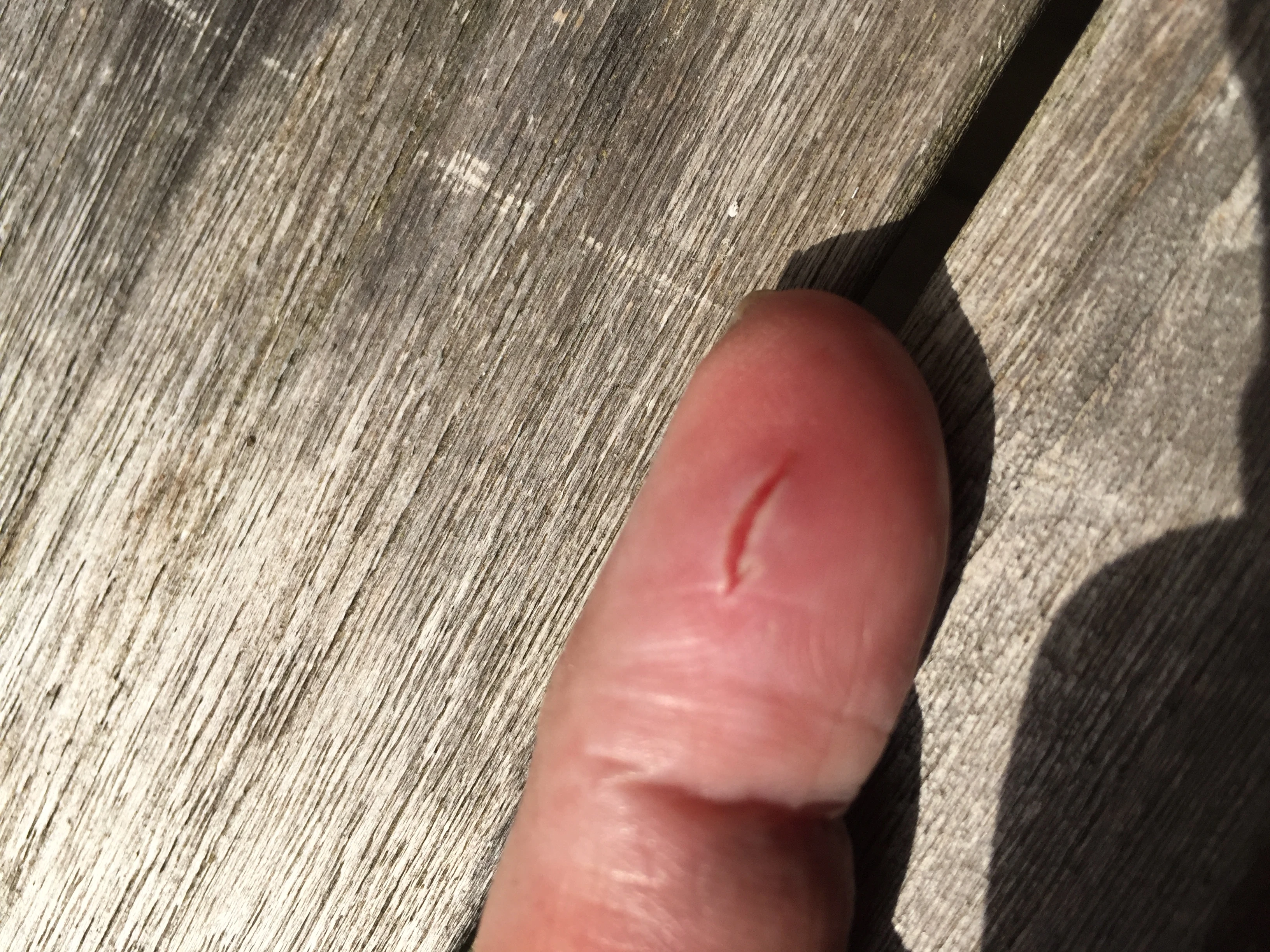 De Vinger